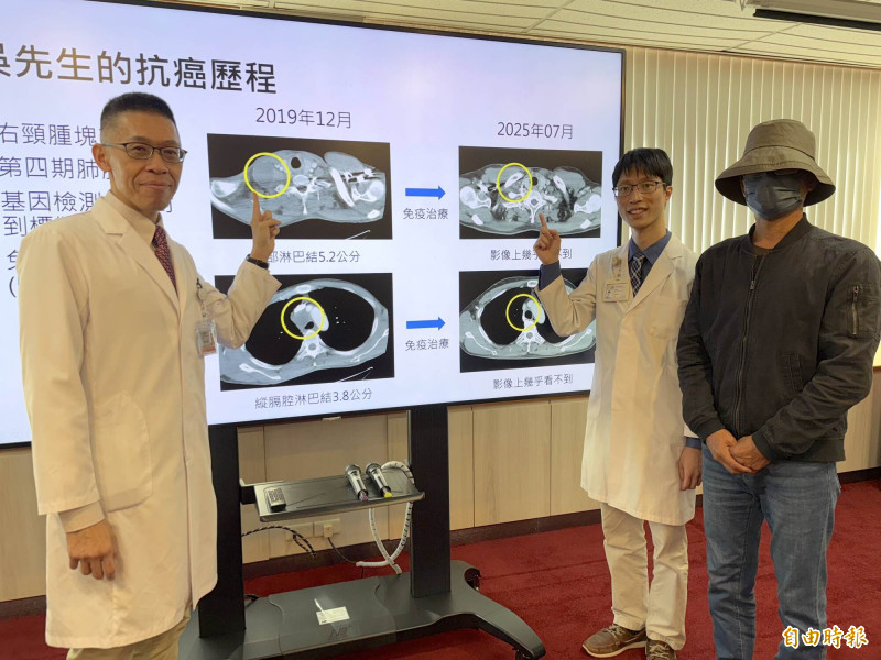 第四期肺腺癌奇蹟逆轉 物流司機靠免疫...