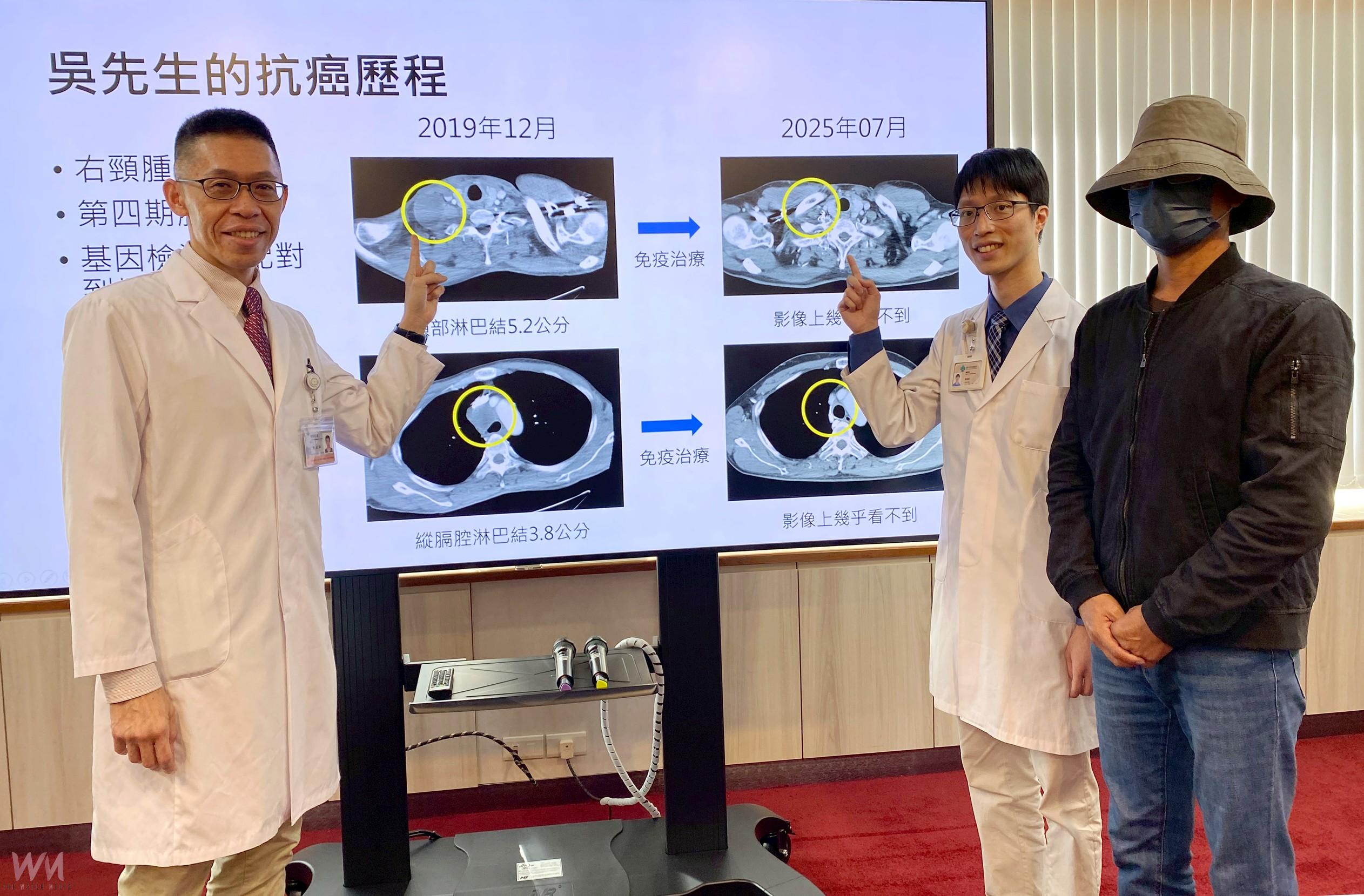 精準醫療改寫肺癌命運　四期病人存活逾6年 扭轉絕望為希望