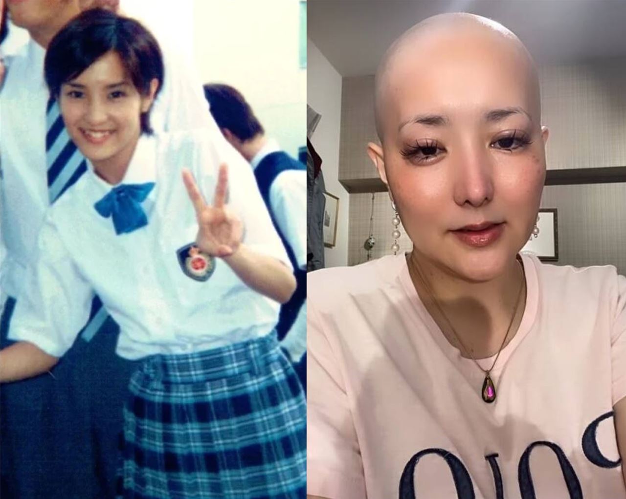 傳病危兩天！45歲《麻辣教師》女星醒...