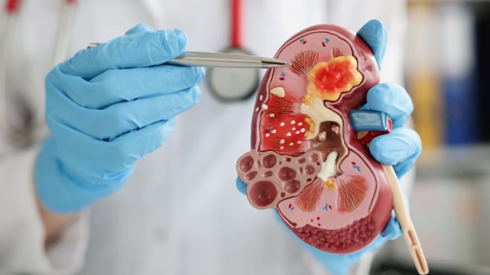 他們30幾歲就洗腎！醫揭「這些疾病」...