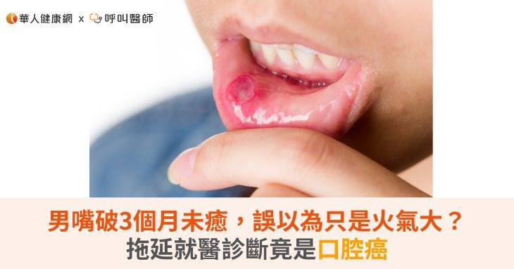 男嘴破3個月未癒，誤以為只是火氣大？拖延就醫診斷竟是口腔癌
